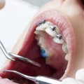 How A Professional Orthodontist And Dentist In Waco Can Improve Your Oral Health