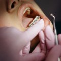 Why You Should Choose A Holistic Dentist For Your Orthodontic Needs In Sydney