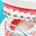 What is included in orthodontic treatment?