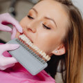 Veneers In Austin: The Perfect Finishing Touch Post-Orthodontics