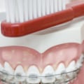 What To Consider Before Choosing An Orthodontic Treatment Plan In Cedar Park For You