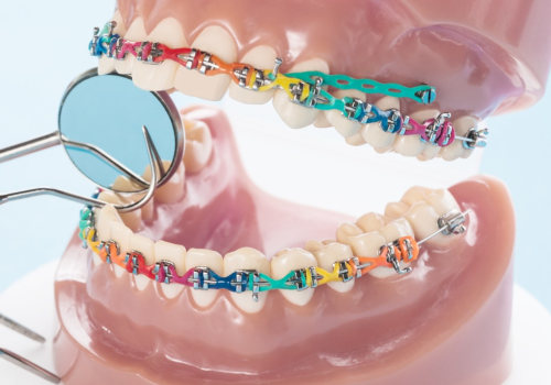 What do orthodontists actually do?