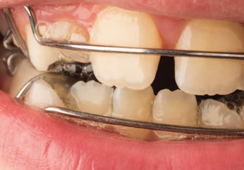 Can an orthodontist do fillings?
