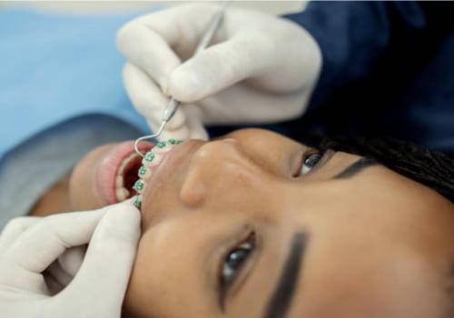 The Role Of Orthodontics In Preventing Gum Disease And Tooth Decay In Monroe, LA