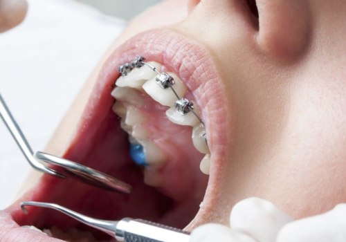How A Professional Orthodontist And Dentist In Waco Can Improve Your Oral Health