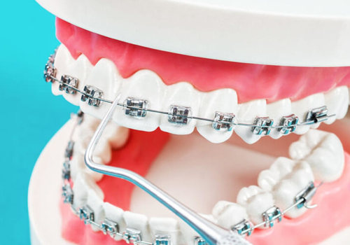 What is included in orthodontic treatment?