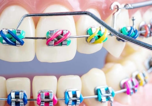 What are the most common orthodontic procedures?