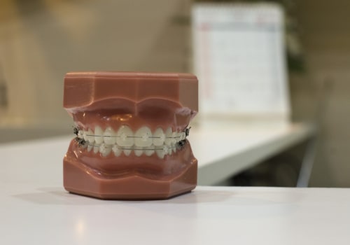 What procedures are considered orthodontic?