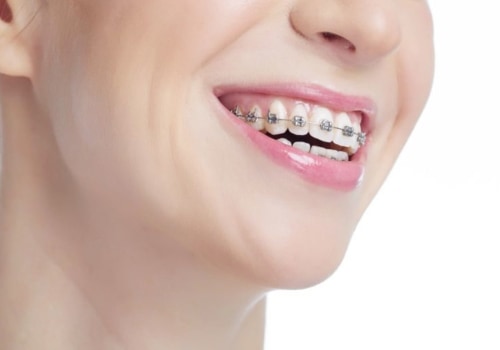 Get That Dream Smile With Orthodontics Services In Austin